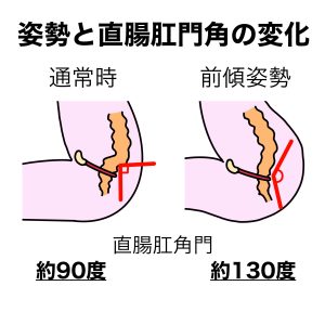 直腸と肛門の角度